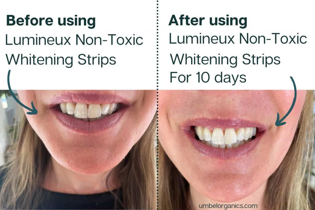 Lumineux Non-Toxic Teeth Whitening Strips Review - Umbel Organics