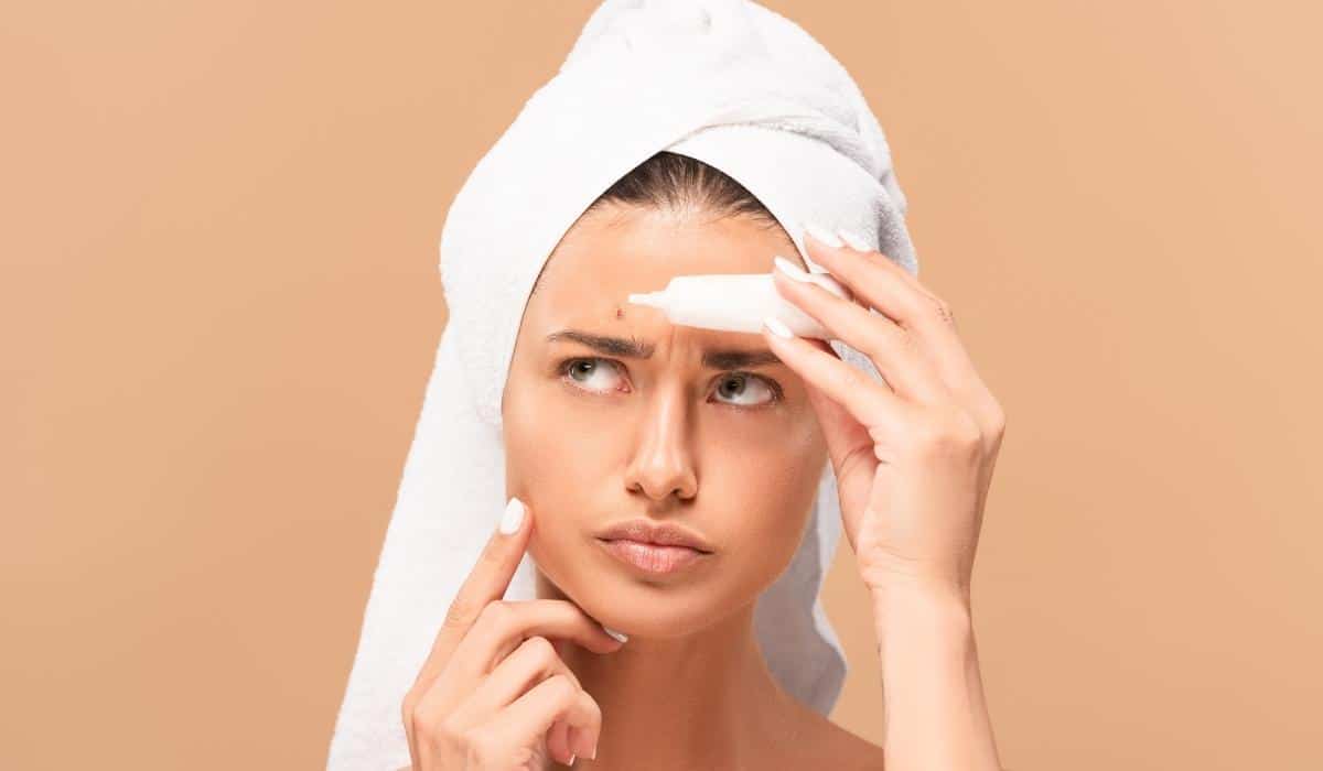 woman applying acne treatment