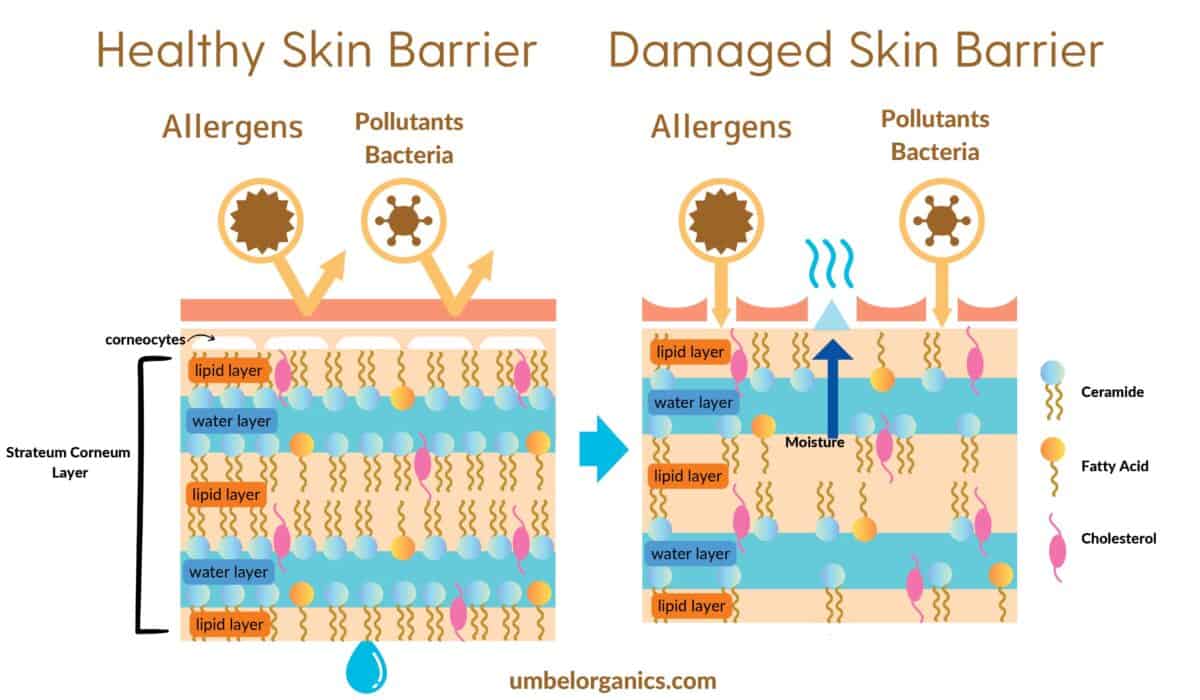Natural & NonToxic Eczema Cream Umbel Organics